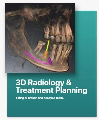 3D Radiology & 3D Treatment Planning