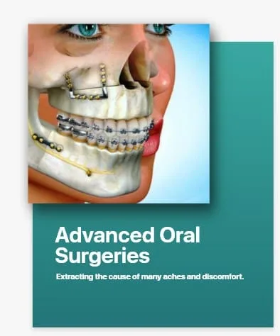 Advanced Oral Surgeries