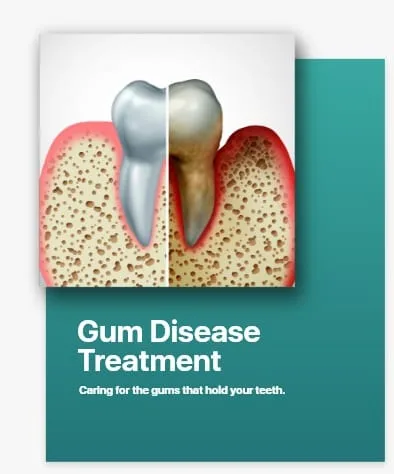 Gum Disease Treatment