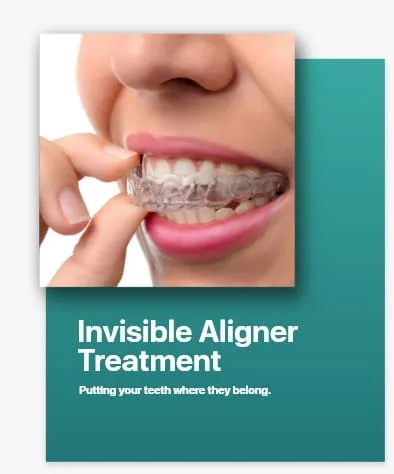 Invisible Aligner Treatment