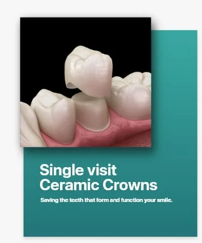 Single Visit Ceramic Crowns