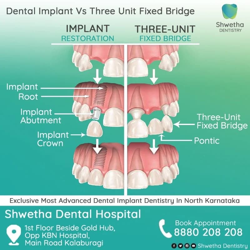Professional dental care